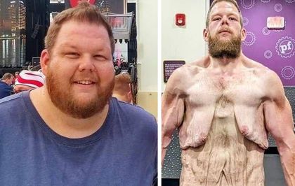 163 kilo verdi ama çilesi bitmedi