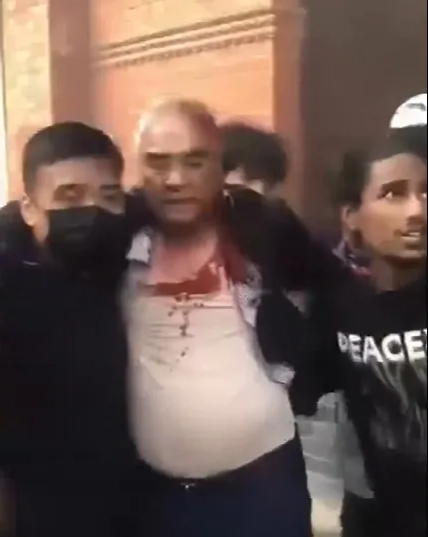 Nepal'de Başbakan ve eşi, öfkeli kalabalık tarafından evlerinden çıkarılıp linç edildi