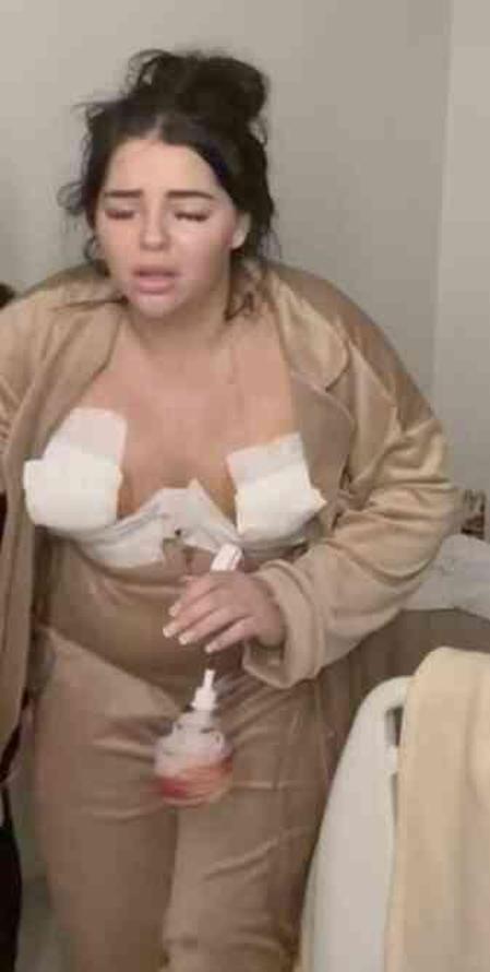 Göğüs dikleştirme operasyonu geçiren İngiliz modelin göğüs uçları çürüdü