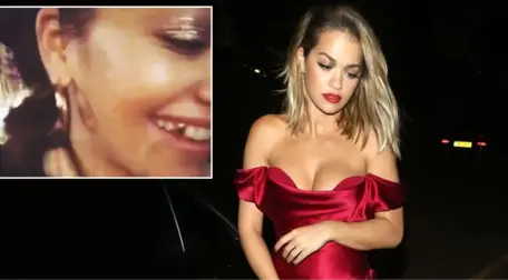 Şarkıcı Rita Ora, Taktırdığı Altın Dişleri Takipçilerine Gösterdi