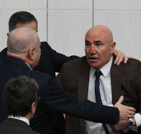 CHP'li vekillerle yumruklaşan Osman Gökçek'in zor anları