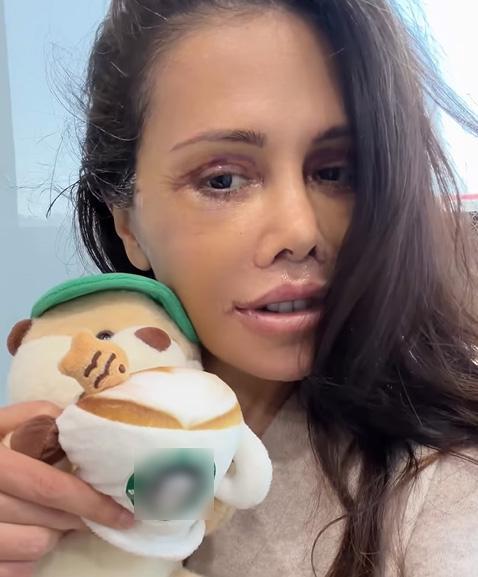 Eski Survivor yarışmacısı Didem Ceran yüz nakli oldu! Son haline yorum yağıyor