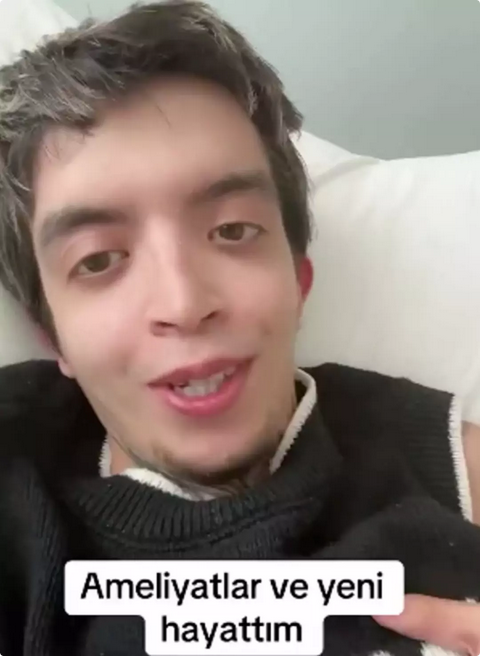 'Tablet Reis' cinsiyet mi değiştiriyor? 7 saatlik ameliyata girecek