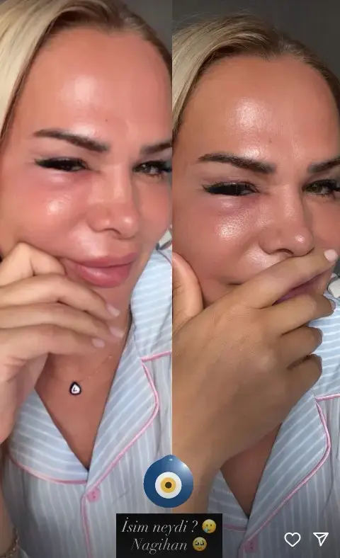 Survivor'ın yıldızı Nagihan Karadere'ye adeta nazar değdi: Şu halime bakın