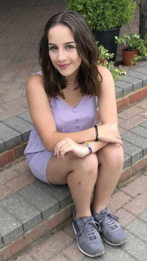 Kendisine karşı alerjisi olan kadın, güldüğünde yüzü yanıp yara oluyor