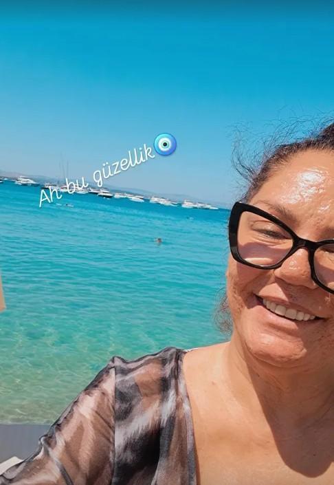 İzel'den cesur paylaşım: Selülitler gerçektir