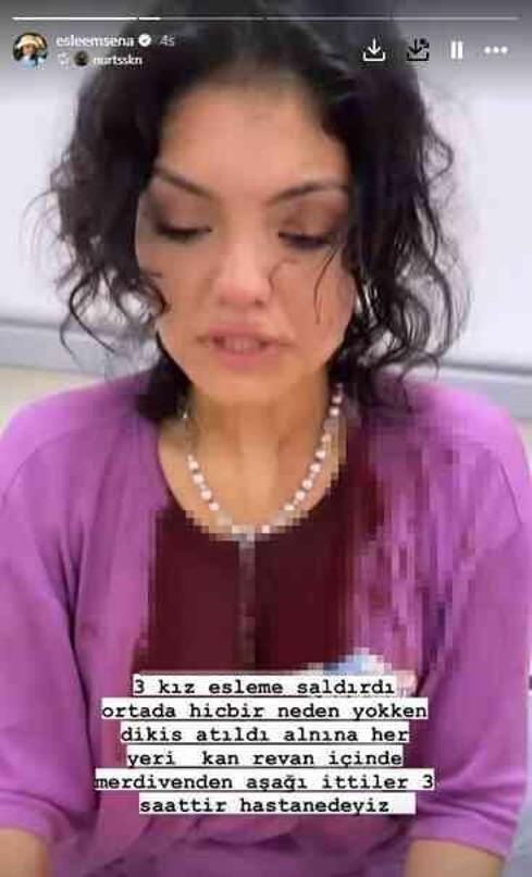 Eslem Sena Nur kimdir, kaç yaşında? Kısmetse Olur Eslem Sena Nur saldırıya mı uğradı?