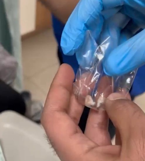 Kulağına gizlediği uyuşturucuyla yakalandı
