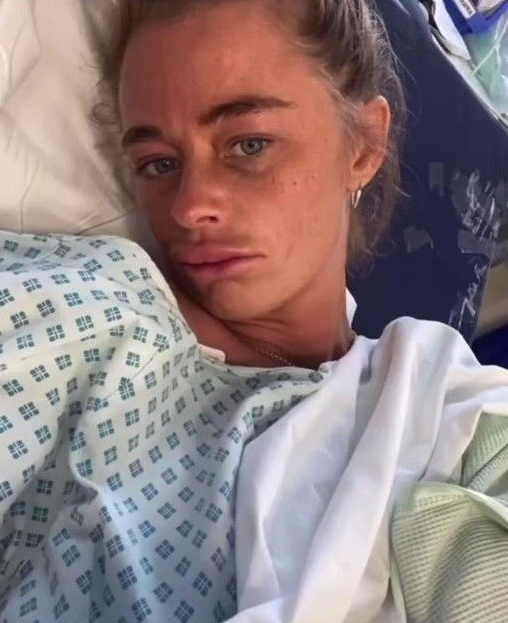 Şişme balıkla çatıdan havuza atlayan kadının yüzü parçalandı