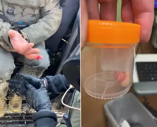 >ICE karşıtı protestolarda şoke eden iddia: Görevlinin parmağını ısırarak kopardılar