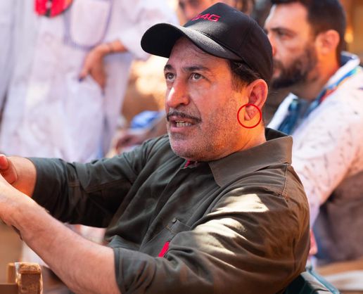 Cem Yılmaz'ın kalp krizi sonrası herkes bu detaya takıldı