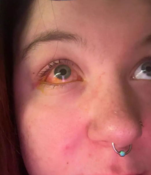 Yatmadan &ouml;nce &ccedil;amaşır yıkadı, sabah uyandığında k&ouml;r oldu