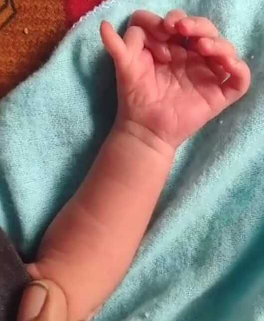 Hindistan'da Bharatpur şehrinde 26 parmakla dünyaya gelen bebek tanrıça olarak görülüyor