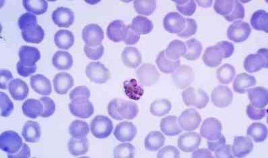 Sivrisineklerdeki gizli tehlike! Sıtma nedir ve neden olur?