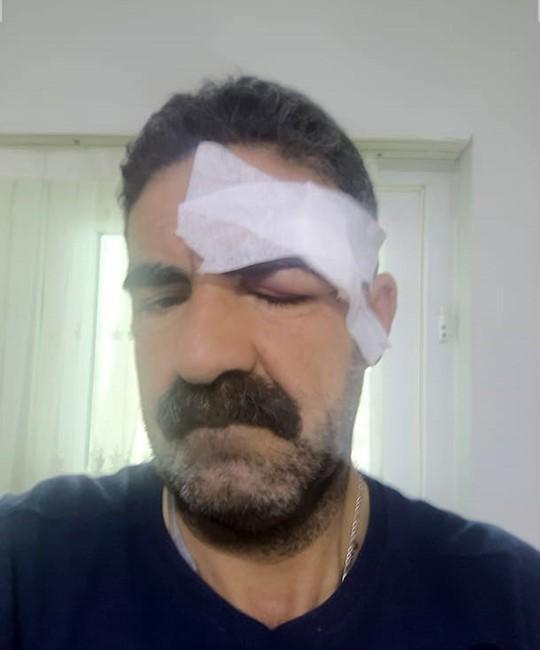 Elazığ'daki kavga, tuvaletini duvara yapan yolcu nedeniyle çıkmış