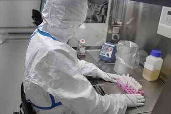 3 günde öldüren EBOLA VİRÜSÜ ne, nasıl bulaşır? Çinli bilim insanları geliştirdi! #129440