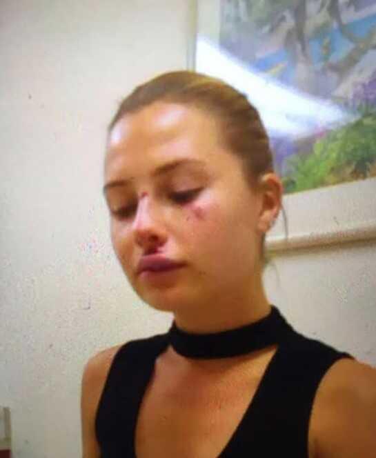 Chloe Loughnan, Serdar Ortaç'la evliliği ve boşanma sebeplerini anlattı