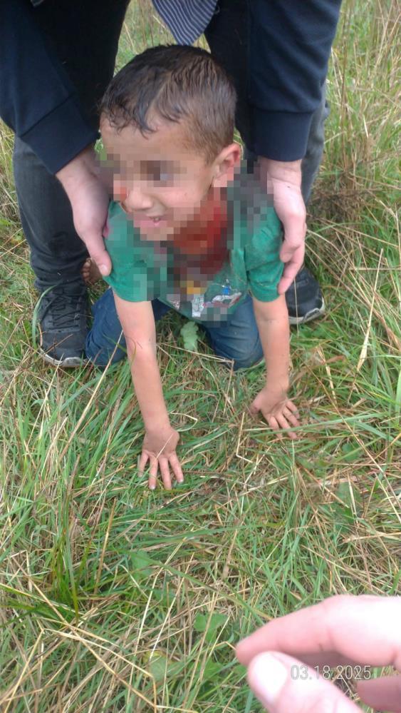 Sahipsiz köpekler 5 yaşındaki çocuğa saldırdı! Görüntüler korkunç