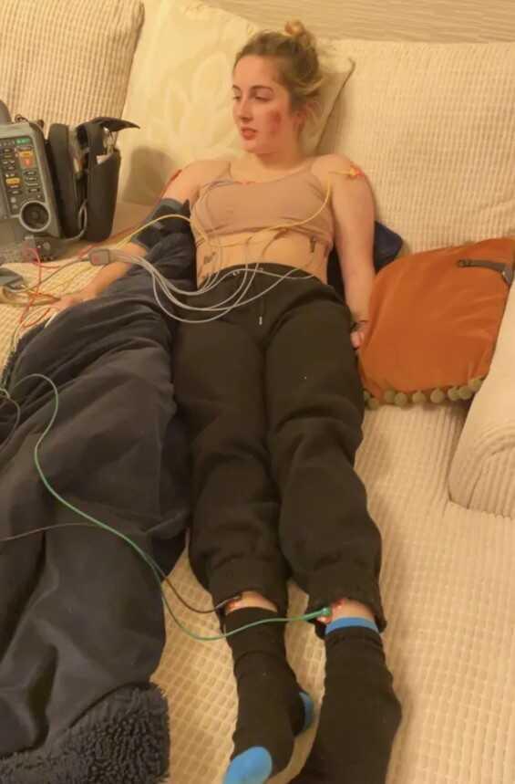 Kendisine karşı alerjisi olan kadın, güldüğünde yüzü yanıp yara oluyor