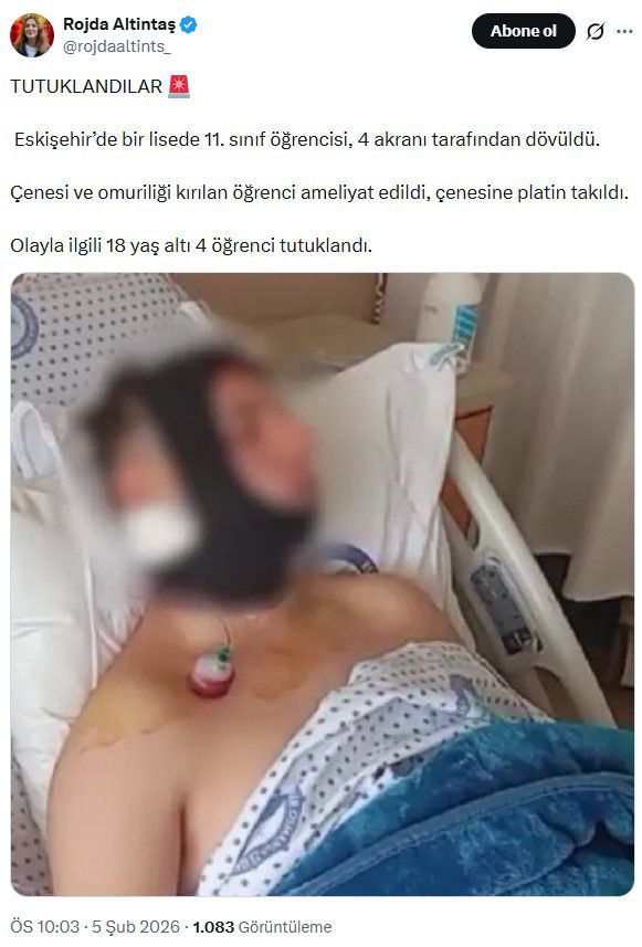 Lise öğrencisini döverek hastanelik eden 4 kişi tutuklandı