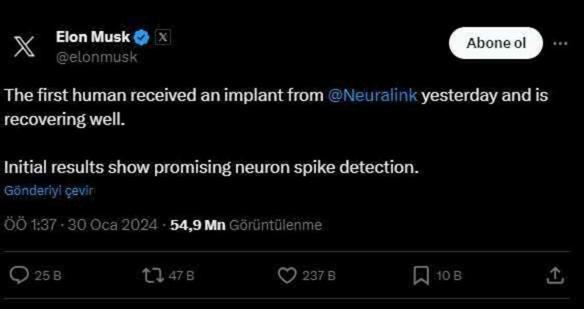 Elon Musk'ın Şirketi Neuralink, İlk Beyin Çipi İmplantını Başarıyla Gerçekleştirdi