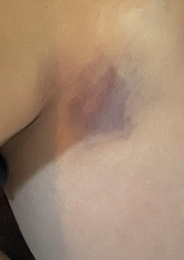 Yıldız Asyalı kocasından şiddet gördüğünü açıkladی