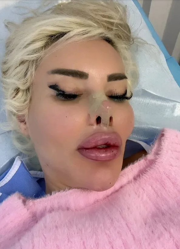 Estetik bağımlısı fenomenin canlı yayında göğsündeki silikonları patladı