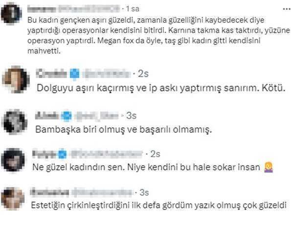 Adriana Lima'nın son hali nasıl? Adriana Lima estetik mi yaptırdı?