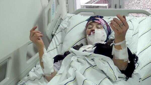 4 kişiyi yaralayan kurdun, kuduz olduğu tespit edildi