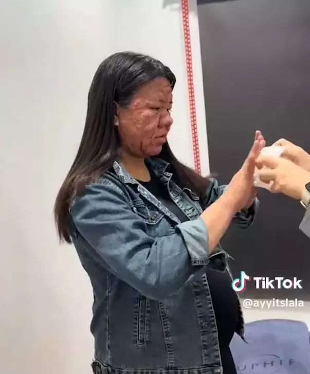 Yok böyle bir değişim: Bir anda onlarca yıl yaşlandı