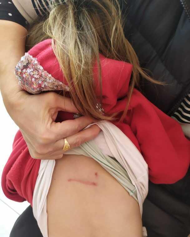 İzmit'te başıboş sokak köpekleri anne kıza saldırdı! Belediye başkanına dava açacaklar