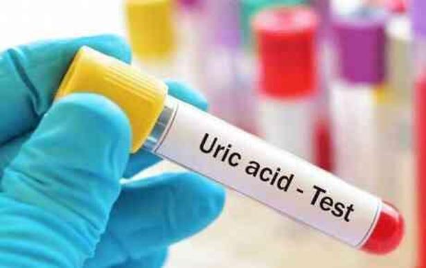 ÜRİK ASİT NEDEN YÜKSELİR? Ürik asit yüksekliği, düşüklüğü neden olur?