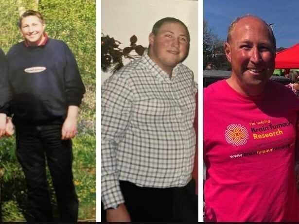 Günde 10 litre su içiyordu! Nedenini araştıran doktorlar çıkan sonuçlar ile şaşkına döndü