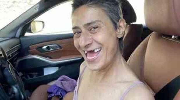 Yıldız Tilbe'nin dişleri neden yok? Yıldız Tilbe'in dişsiz pozu olay oldu!