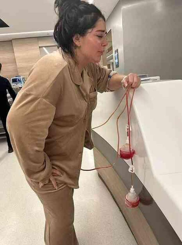 Göğüs dikleştirme operasyonu geçiren İngiliz modelin göğüs uçları çürüdü