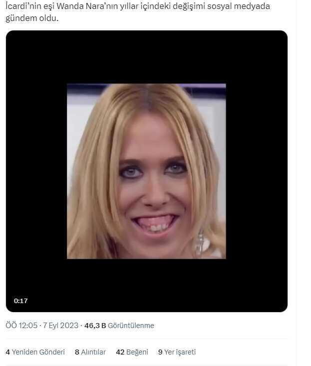 Fotoğrafın Wanda Nara'nın estetiksiz halini gösterdiği iddiası
