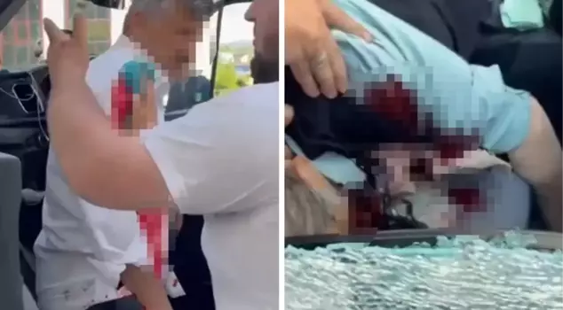Bloodshed in traffic argument in Rize: 1 dead, 1 injured.