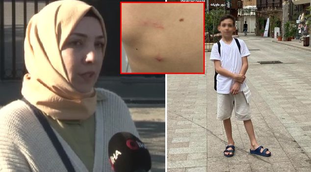 هاجم كلبان كانجال يربيهما مدير المدرسة طالبًا يبلغ من العمر 11 عامًا.