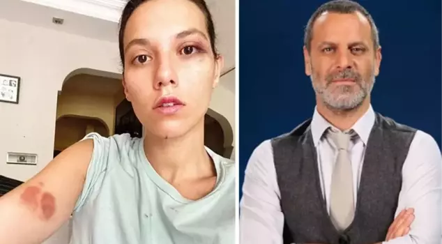 The violence case between Deniz Bulutsuz and Ozan Güven has been postponed.