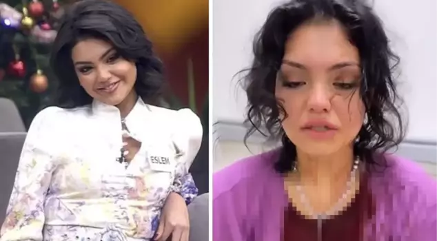 Kısmetse Olur contestant Eslem Sena Nur was attacked by 3 women! They stabbed her head with a knife and pushed her down the stairs.