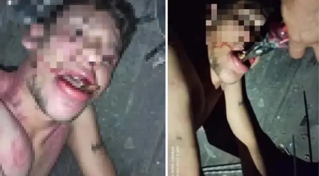 Torture to the 22-year-old worker demanding his salary! They pulled out his teeth with pliers and forced him to eat insects.