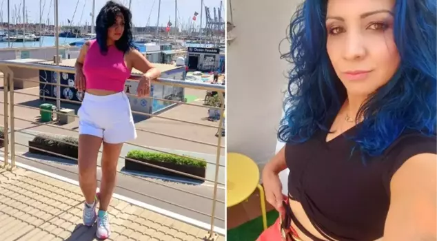 A woman who came from Spain to Istanbul to have a cosmetic surgery died after the operation.