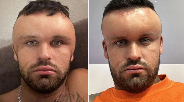 The head of the man who showed an allergic reaction to hair dye turned into a cartoon character.