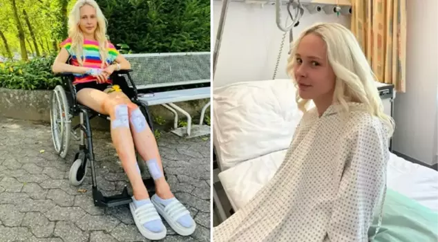 The model underwent a height extension surgery by spending $167,000 after his/her partner said, 