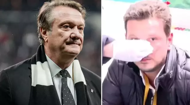 After the derby, Sezgin Gülnar, who broke the reporter's nose, was arrested.