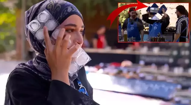 A MasterChef contestant had hot oil poured on their face.