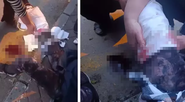 Stray dog brutality in Ankara: A female academic's face and leg were mutilated.