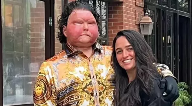 The man who was the first in the world to receive both a face and double hand transplant has gotten engaged.