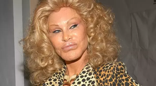 Jocelyn Wildenstein, known as 