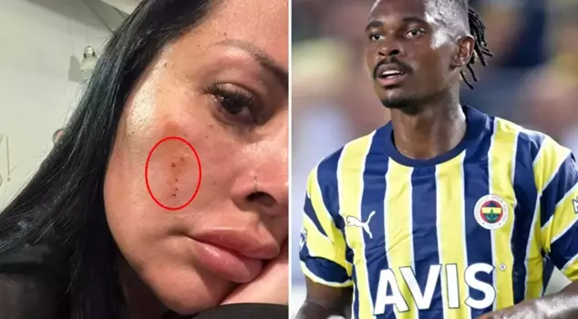 Fenerbahçe player Lincoln Henrique's wife, Adriana Müller, was attacked in the middle of the street.